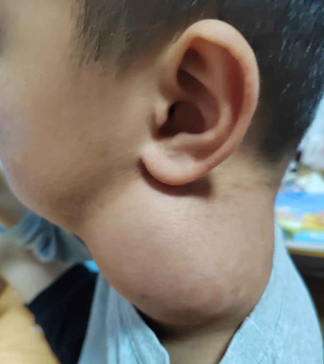他是“泡泡宝贝”，也是一颗顽强的“石头”