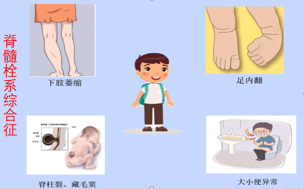 1-250F42120032R.png