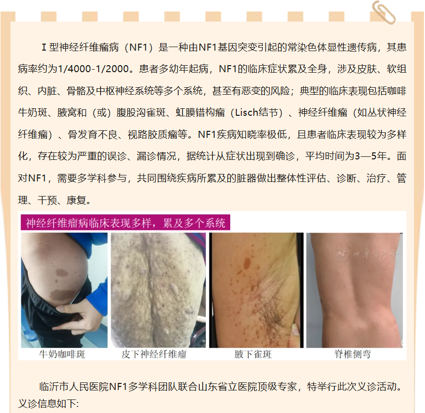 临沂人民医院神经纤维瘤义诊 报名进行中