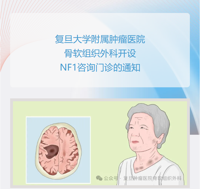 复旦大学附属肿瘤医院骨软组织外科开设Ⅰ型神经纤维瘤病专病门诊