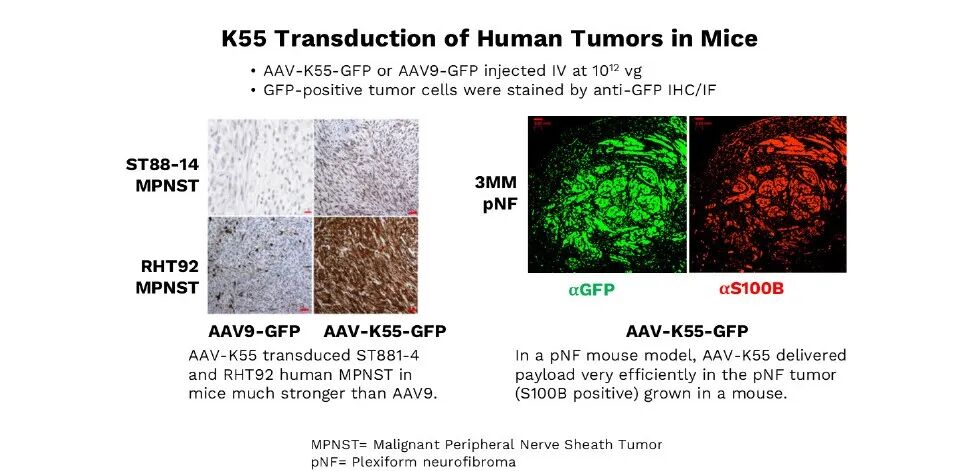 神经纤维瘤基因疗法：JHU白仁远教授团队开创治疗新篇章
