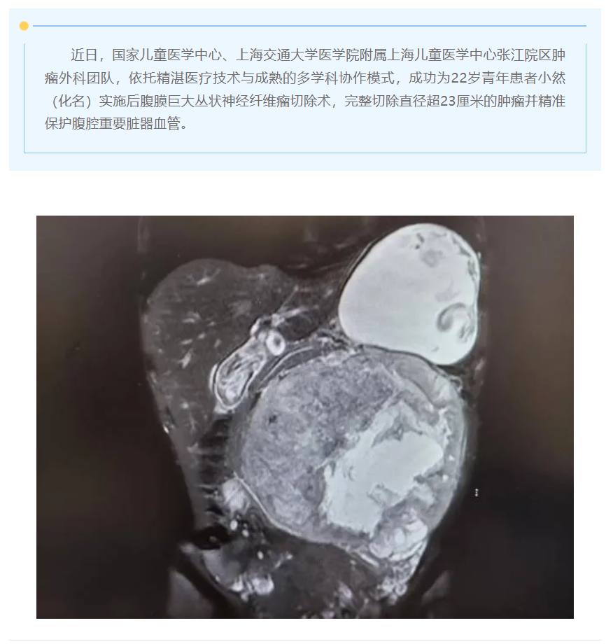 上海儿童医学中心超龄连续性医疗服务为22岁青年生命护航
