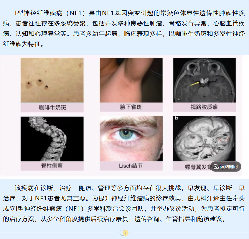 唐都医院I型神经纤维瘤义诊 报名进行中